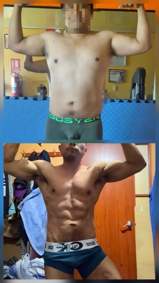 Antes y después de Médico de hospital